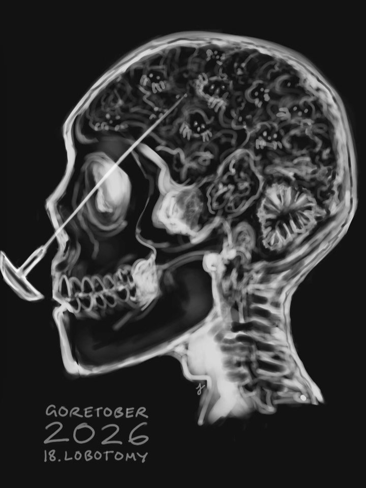 Goretober Day 18: Lobotomy 

Drawn with Procreate ✍🏻
#xxanemiagoretober2026 #goretober2026 #horrorart