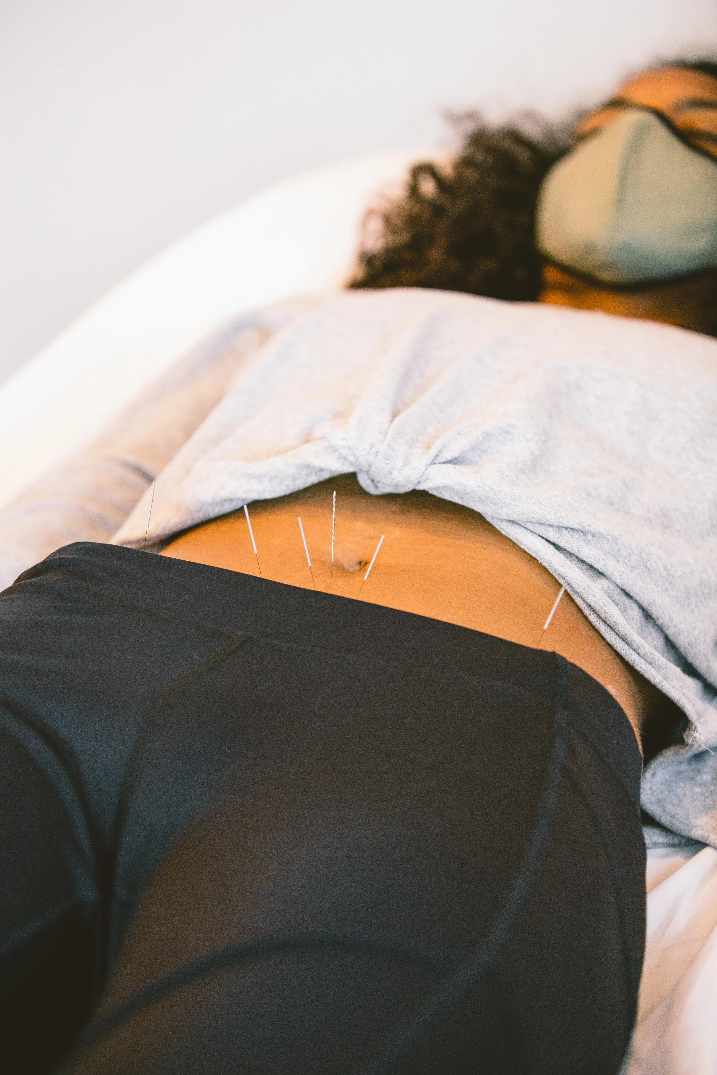 Acupuncture the Ultimate Immune Warrior, a Lesson in Autoimmune Support