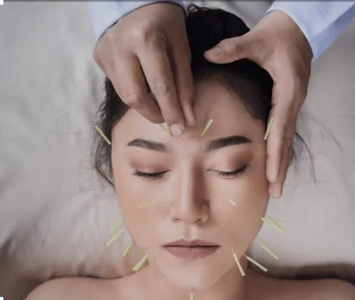 The Gentle Lift: Cosmetic Acupuncture at True North Acupuncture in Denver