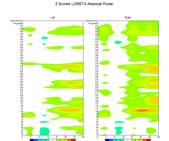 Loreta-map-after-first-visit-540x450.png