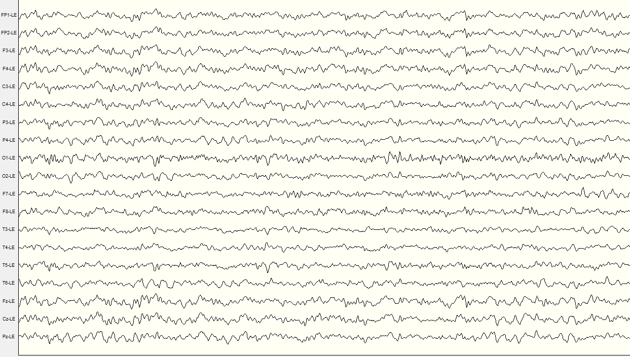 Sample EEG.png