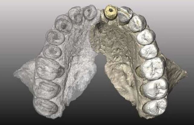 mandibula-5.jpg