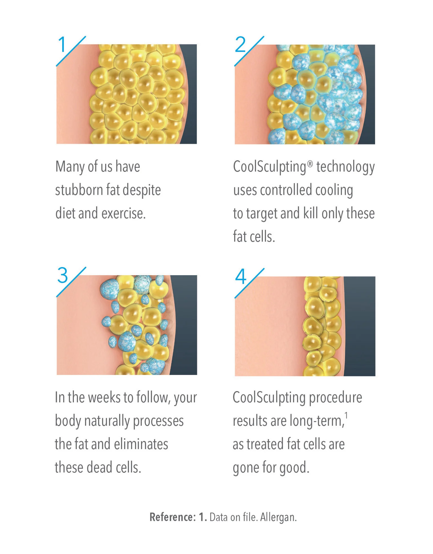 coolsculpting-illustration-square.jpg