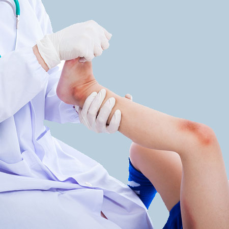 Ankle Injuries