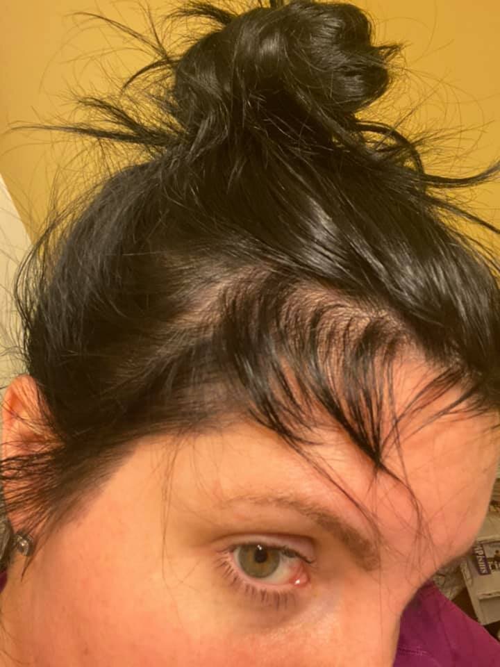What the heck! My hair is falling out! — 4th Trimester Fitness