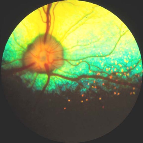 Beagle tapetal islets.jpeg