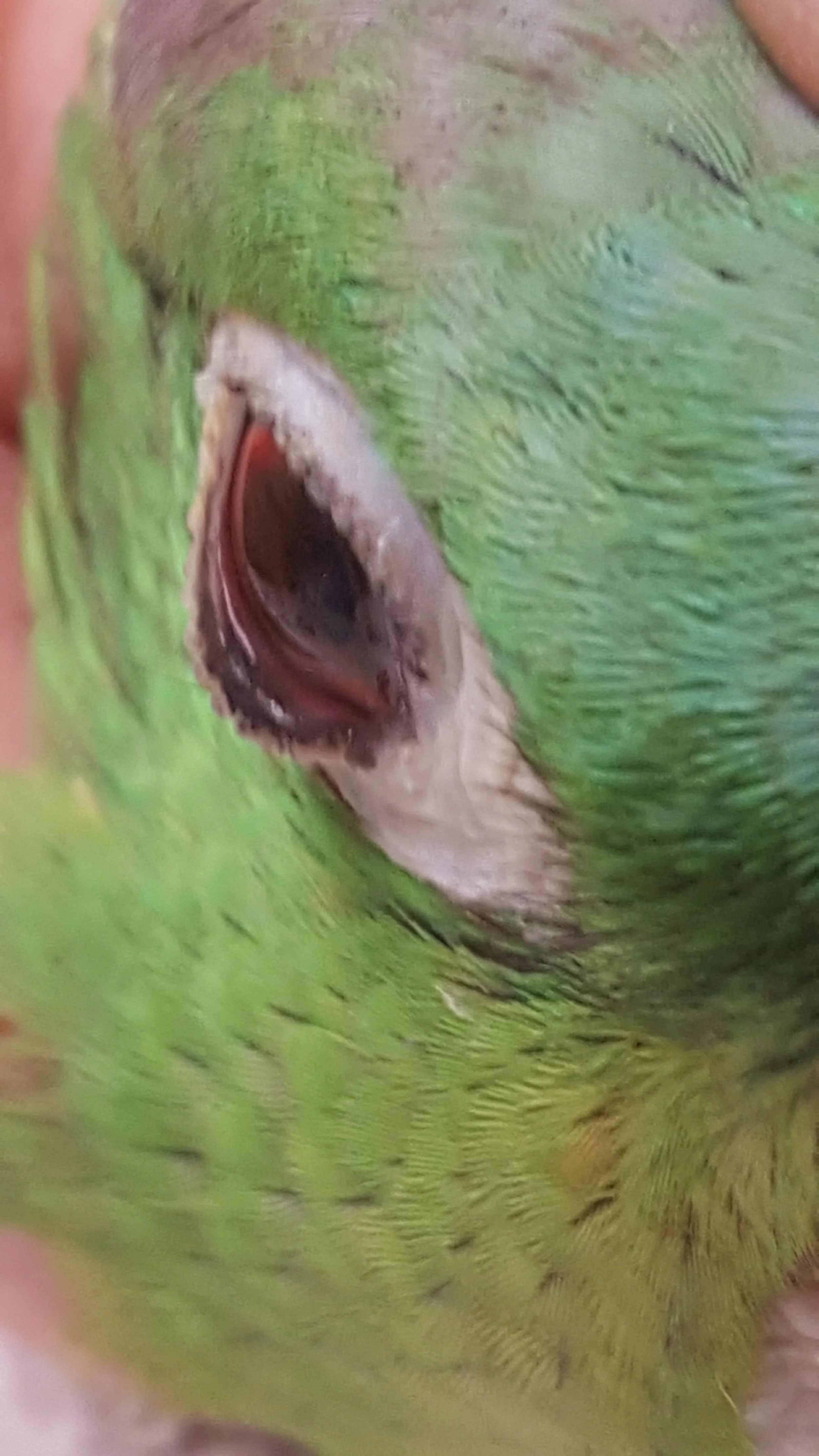 Right Eyelid