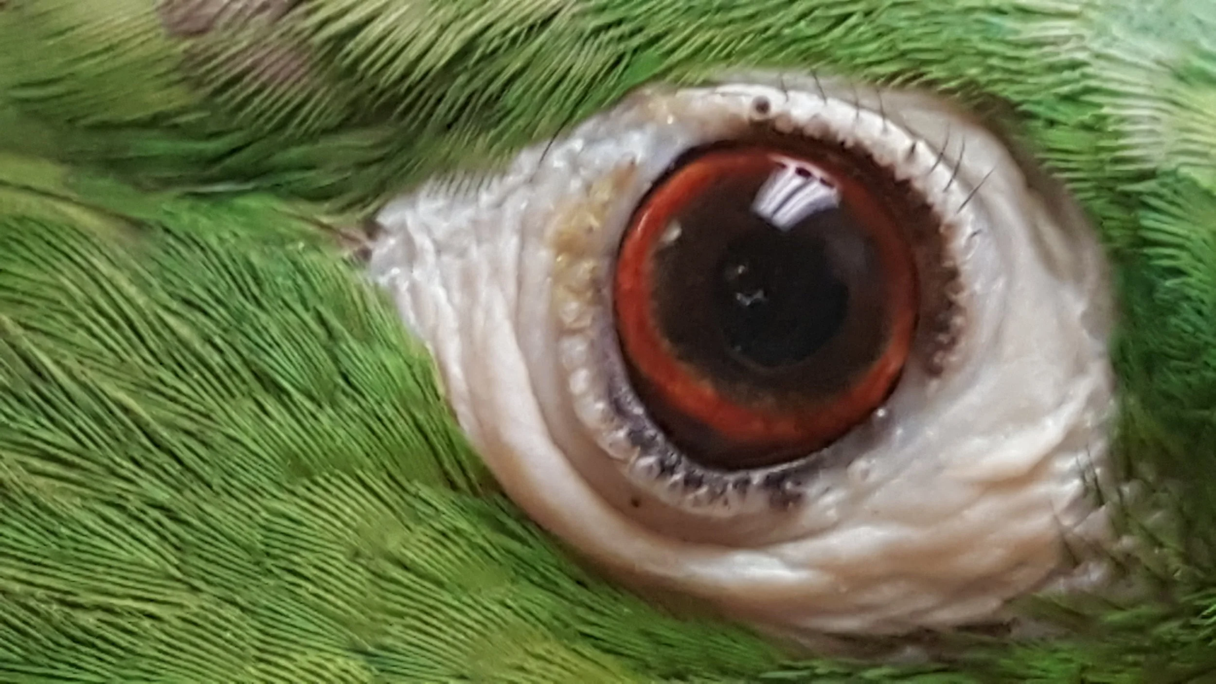 Right Eyelid