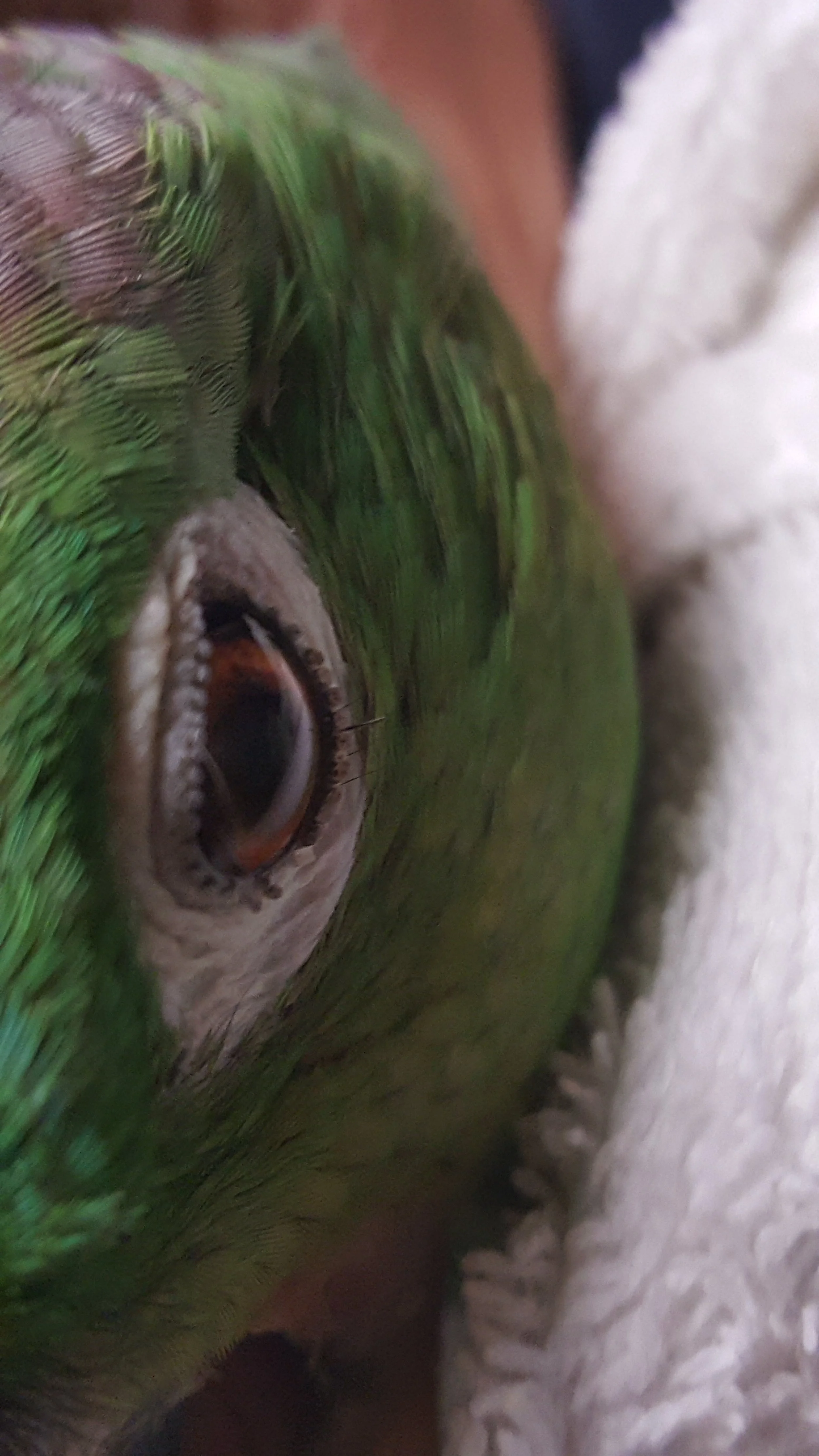 Left Eyelid