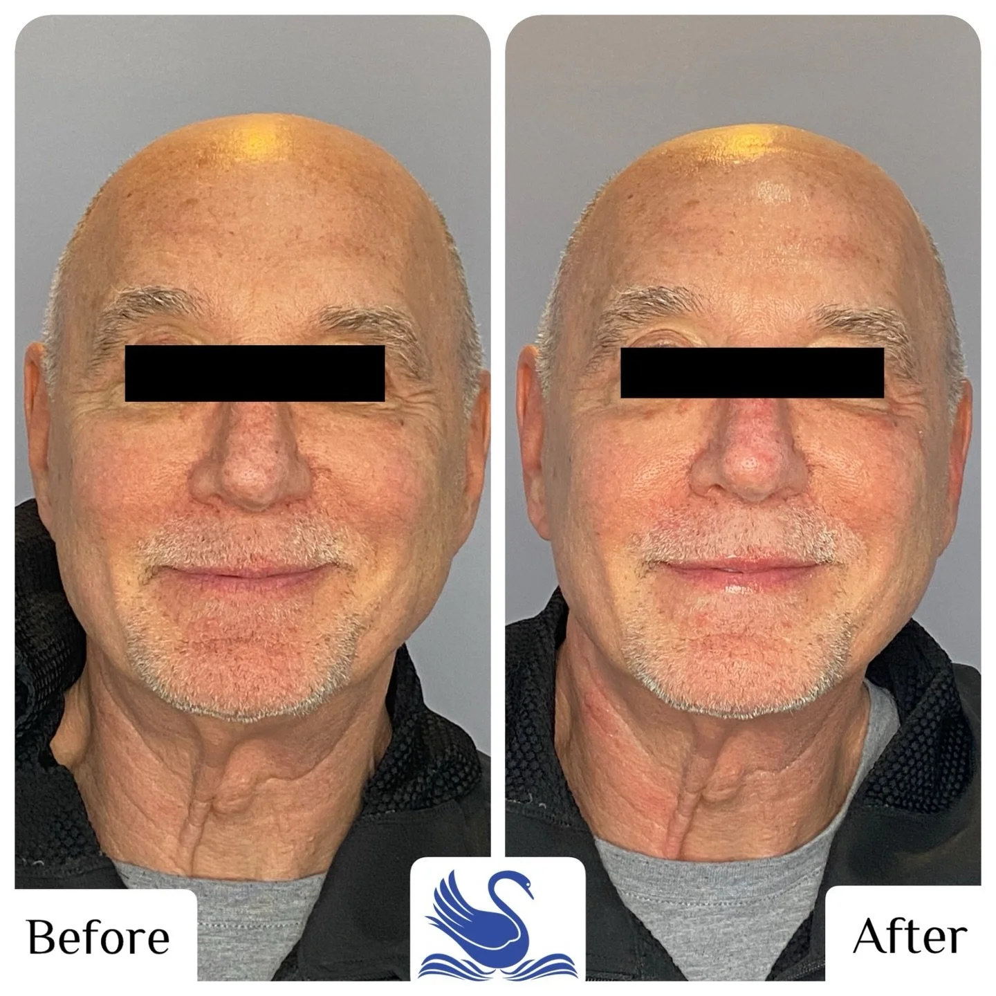✨Resurface &bull; Rehydrate &bull; Reduce fine lines✨
Each season has its own impact on our skin, making NOW the best time to BOOK your next facial! 🌸
&mdash;&mdash;&mdash;
It&rsquo;s not just a service, it&rsquo;s an experience.&reg;