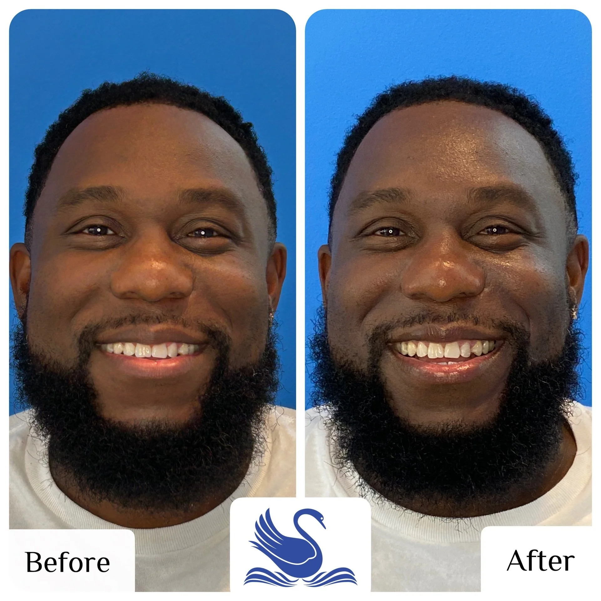 👀💭 Wait, who is that? Is that Denzel? 
&mdash;&mdash;&mdash;
It&rsquo;s not just a service, it&rsquo;s an experience.&reg;
&bull;
&bull;
&bull;
#SerenitySkinCareAndBodyWellness #BlackOwned #DaySpa