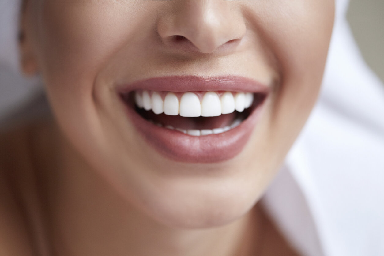 A Few Basics of Cosmetic Dentistry Smiles by Bergen Dental