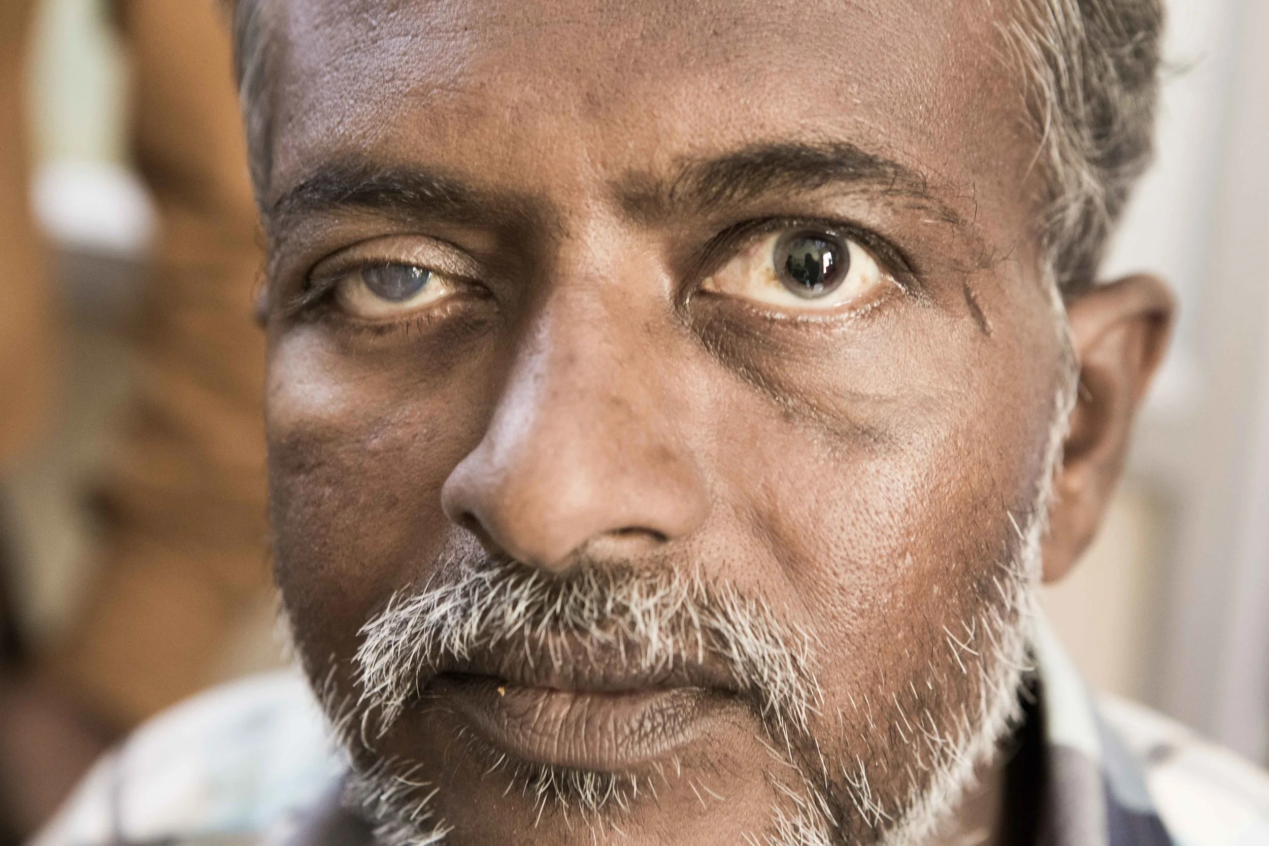 With one eye blind and the other eye having deteriorating vision , it can be very challenging for such people and having their eyes checked up regularly helps. District Hospital Tumkur, Karnataka
