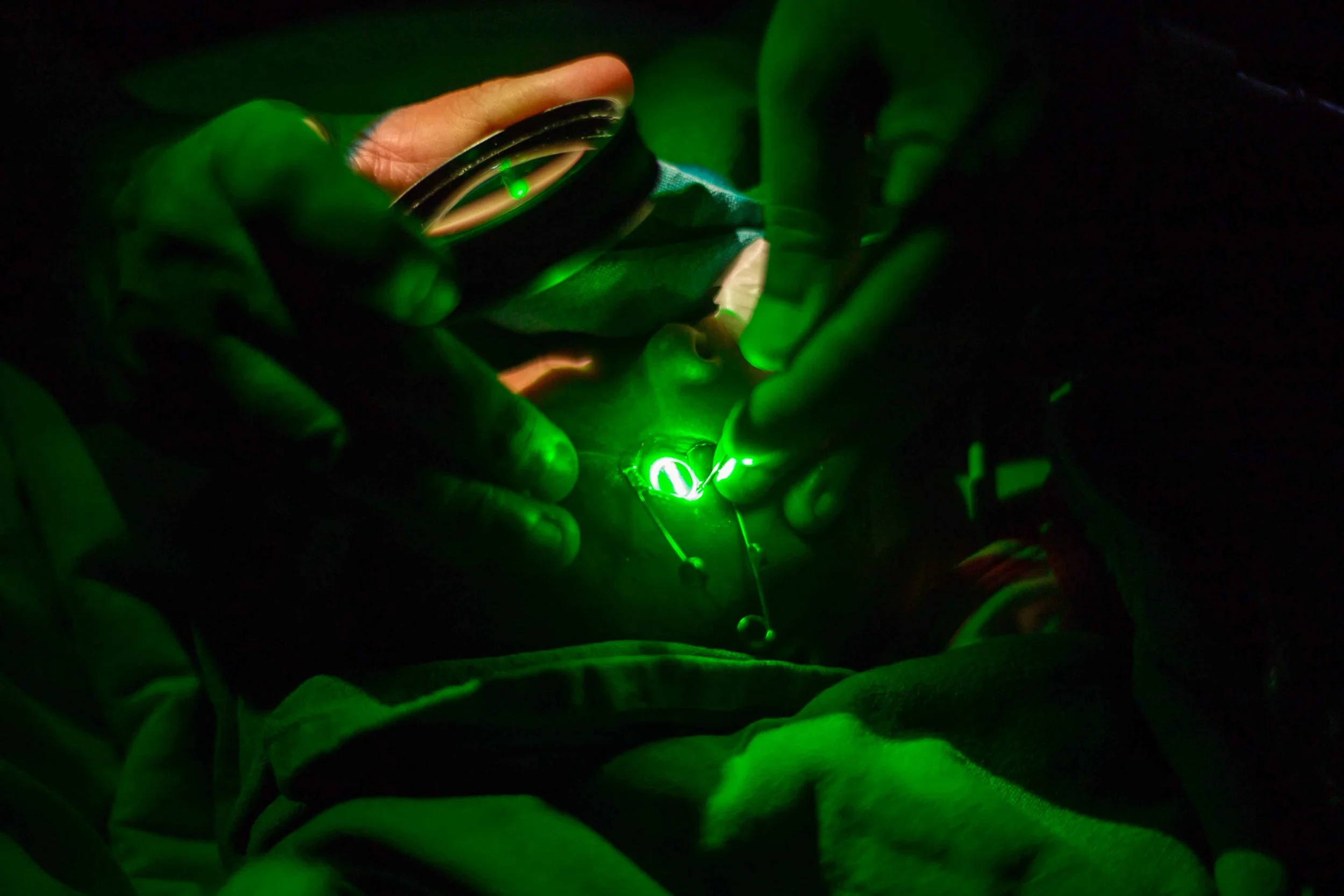Closeup of the laser being applied on a ROP baby. PVRI Hyderabad