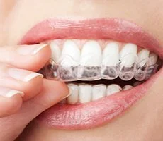 Orthodontics