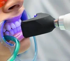 Teeth Whitening