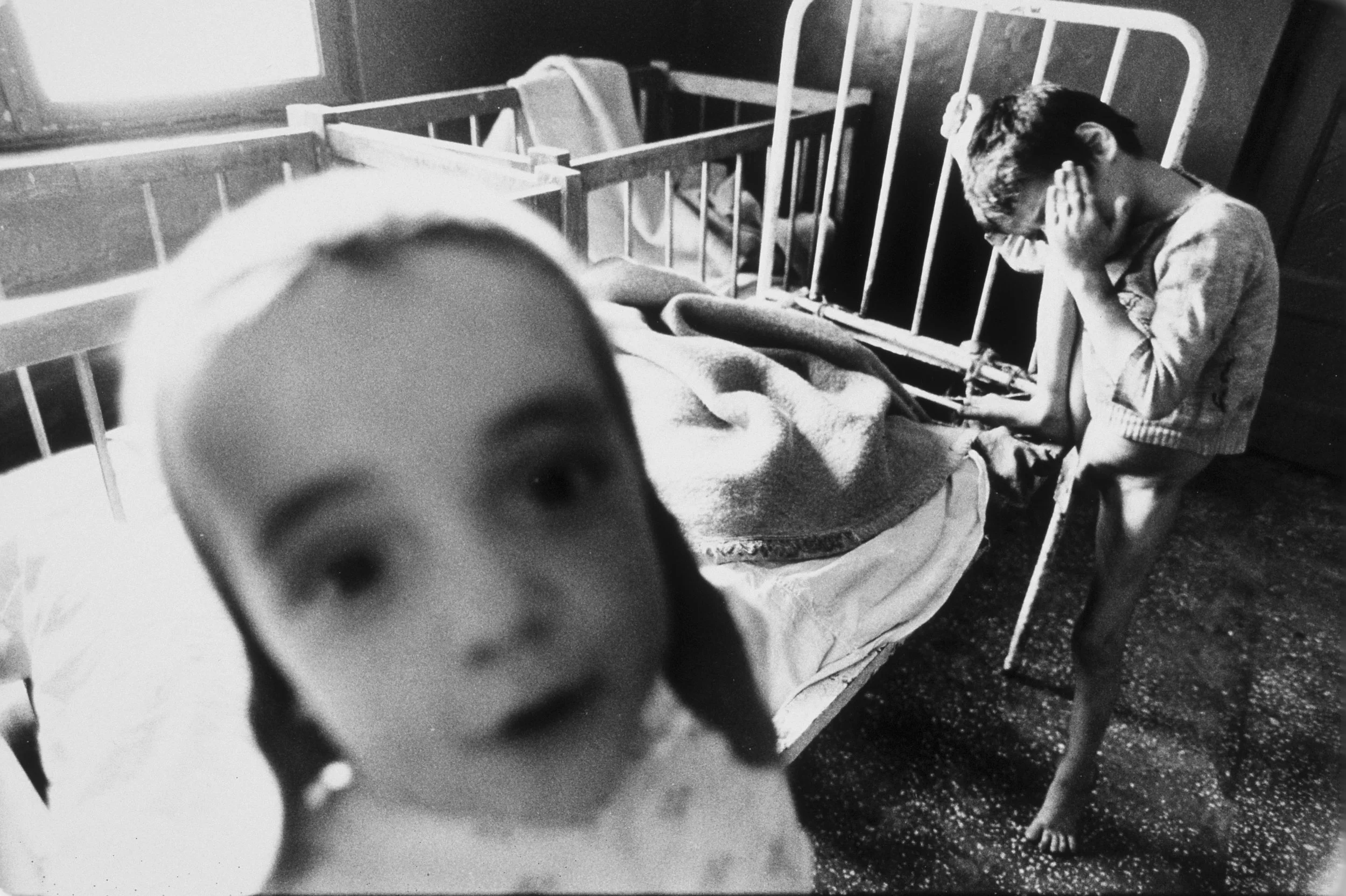 Romania orphans tied leg.jpg
