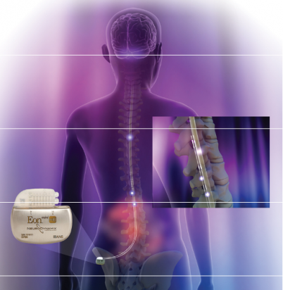 neuroestimulador.png