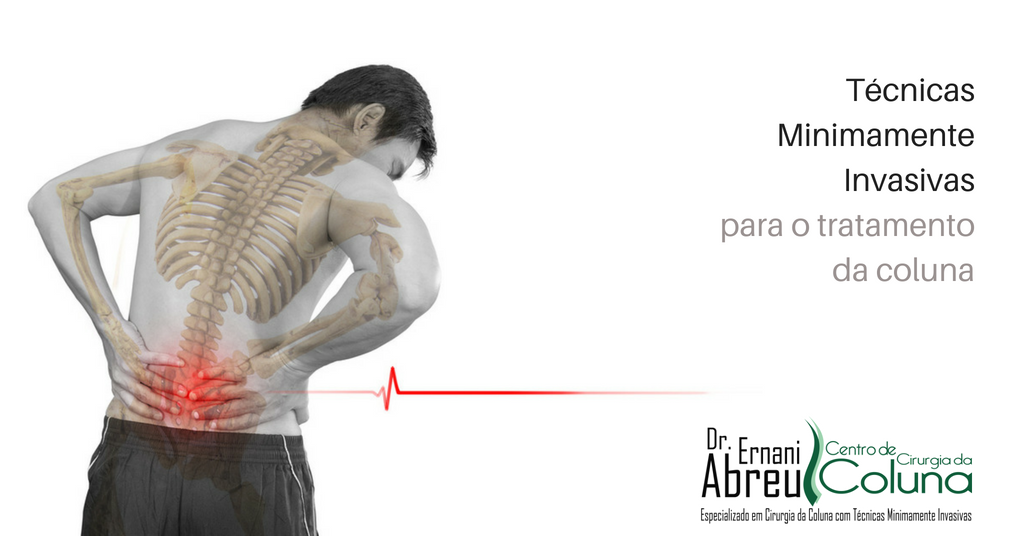 Técnicas Minimamente Invasivas - Dr. Ernani Abreu - Centro de Cirurgia da Coluna
