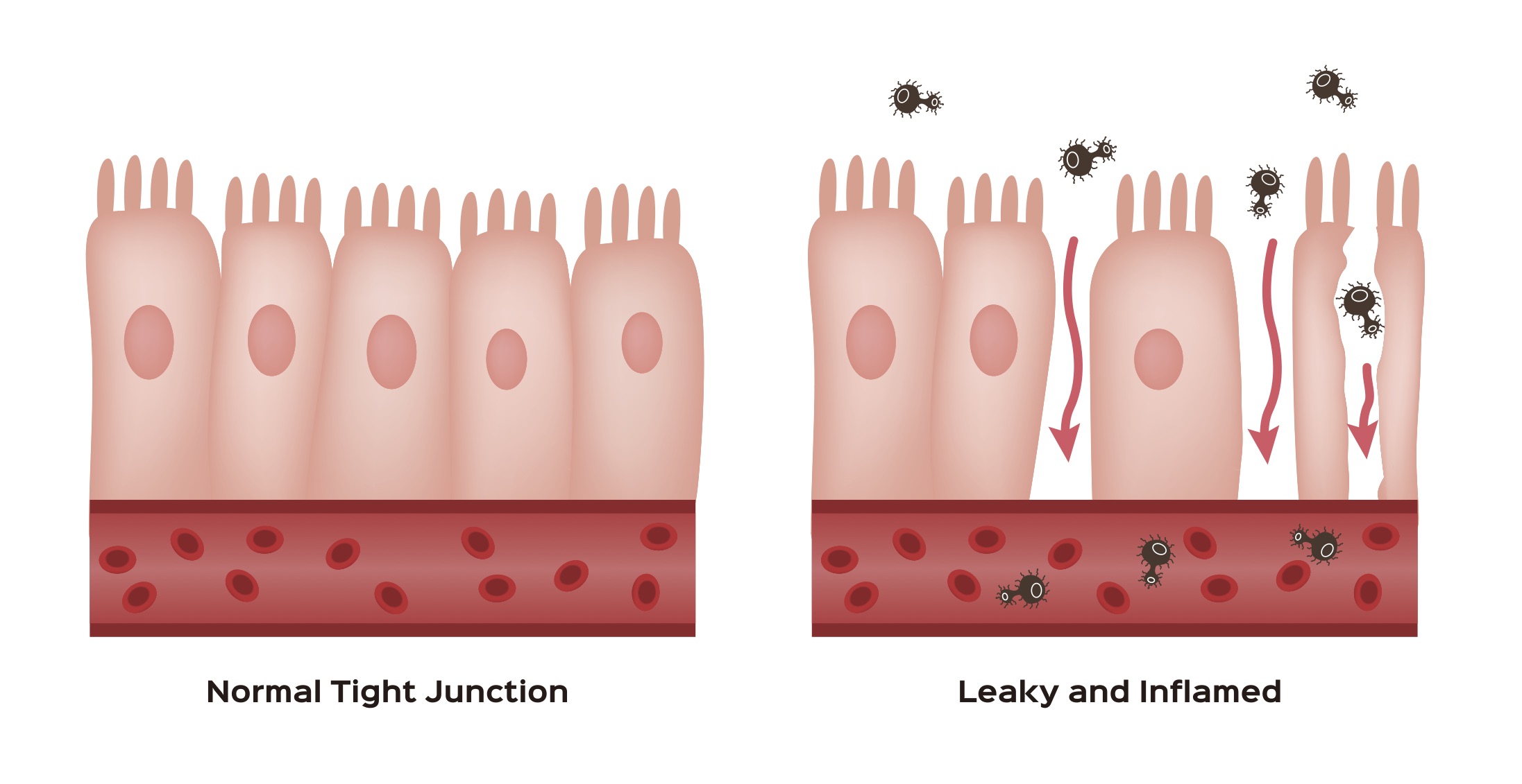 epithelial lining picture.jpg