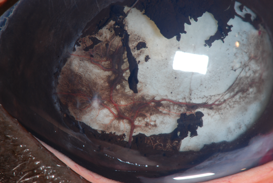 Equine Recurrent Uveitis 