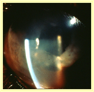 Anterior Uveitis Cat Differentials