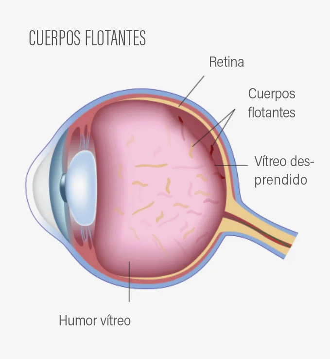 CuerposFlotantes.jpg