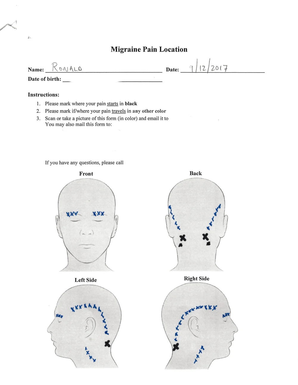 My Typical Migraine Symptoms Jawhacks