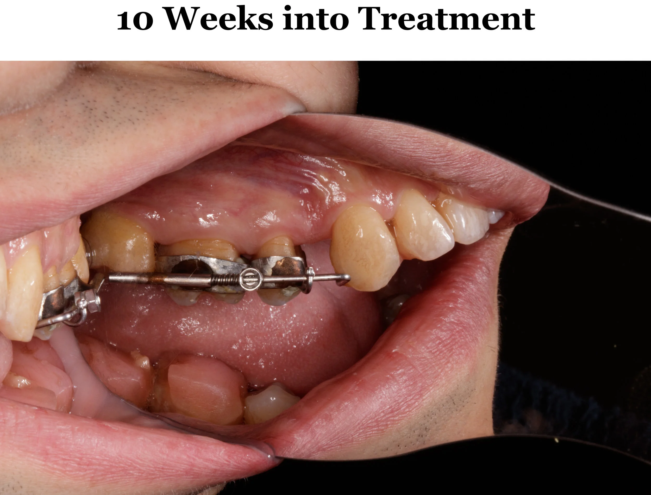 10 Weeks Left.jpg
