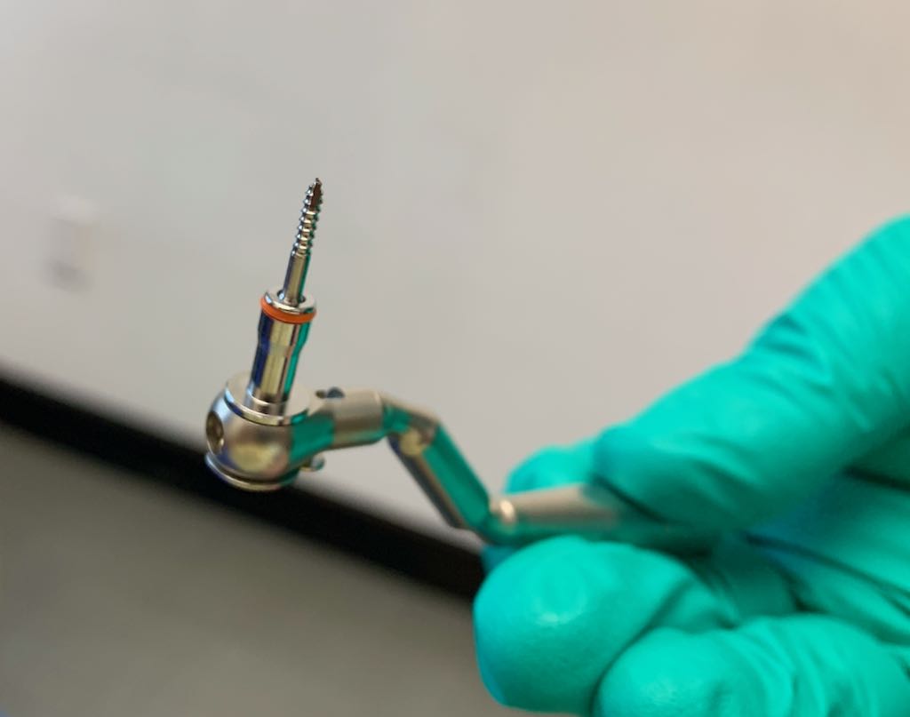 Dr. Newaz holding one of four 11mm screws placed in the maxilla as part of MSE install. Long screws are necessary in order for the MSE to transfer its splitting force to as much maxillary bone as possible, so that it can win its battle with the mid-palatal suture.