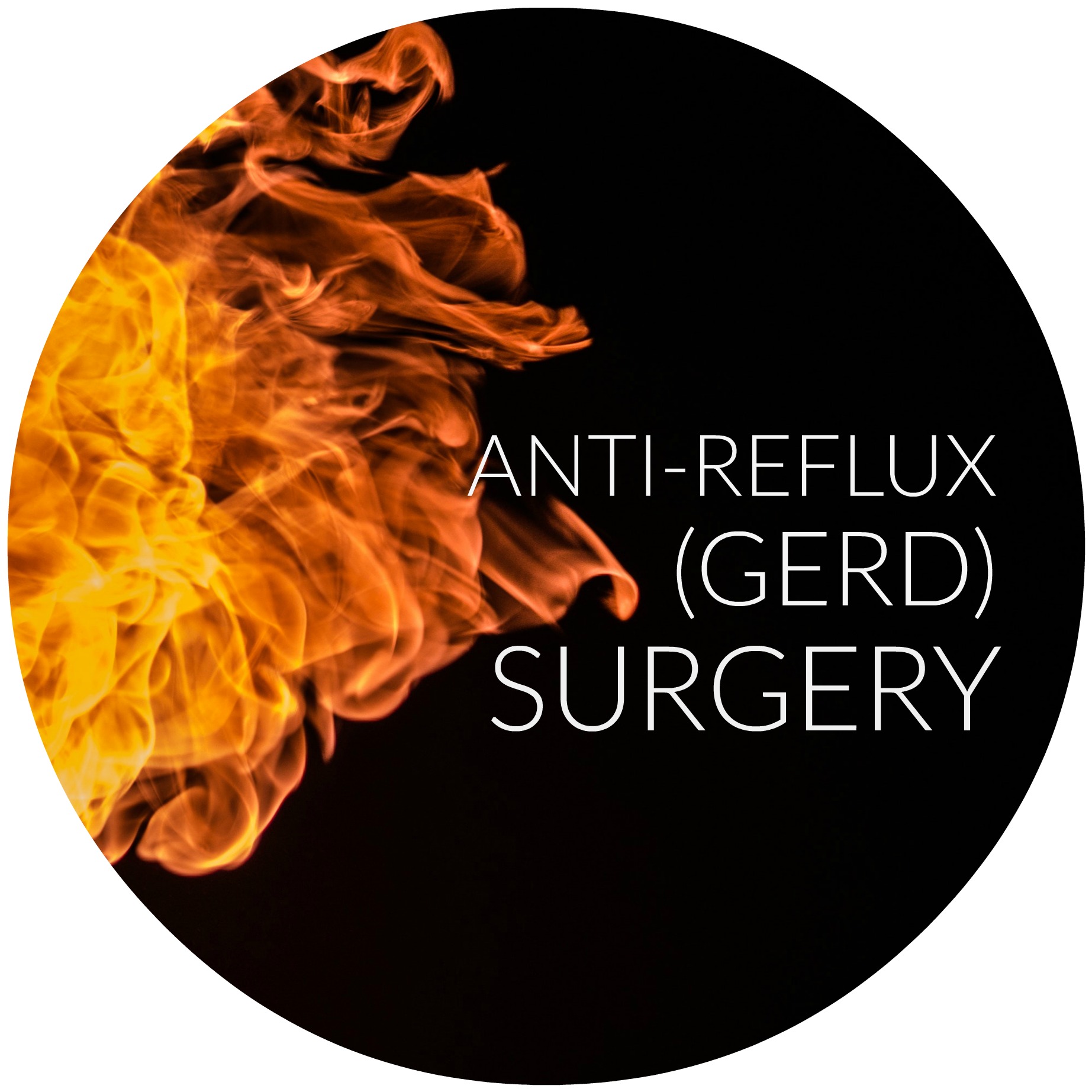 Anti-Reflux (GERD) Surgery