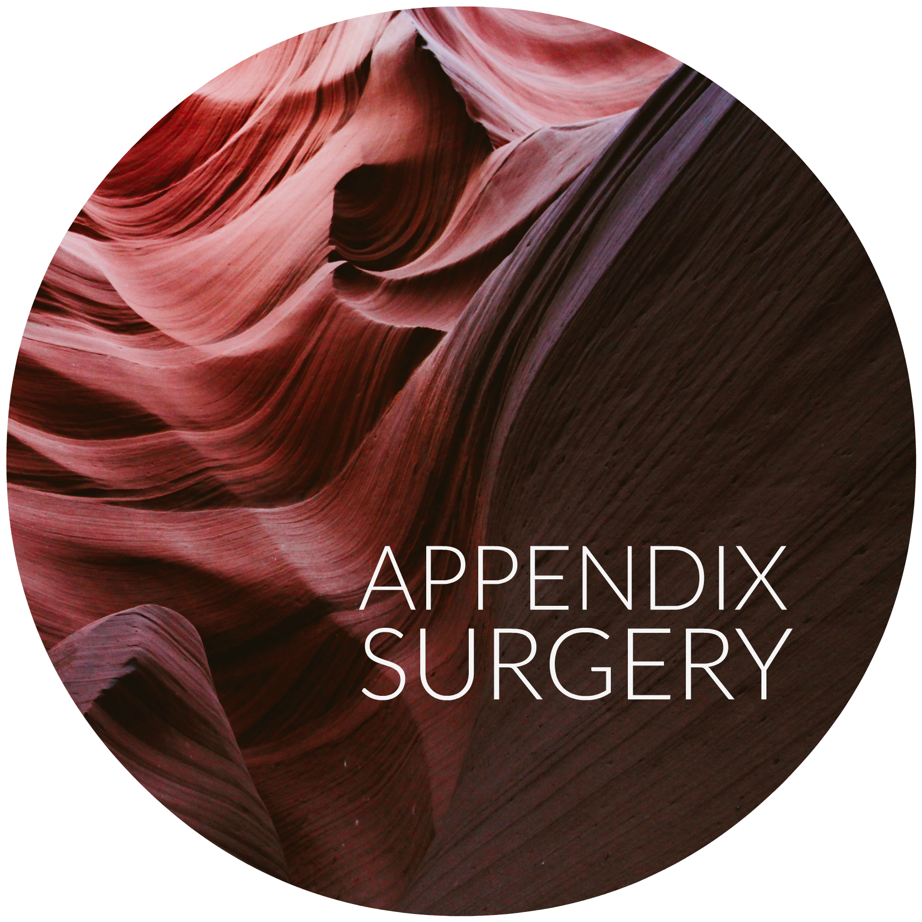 Appendix Surgery