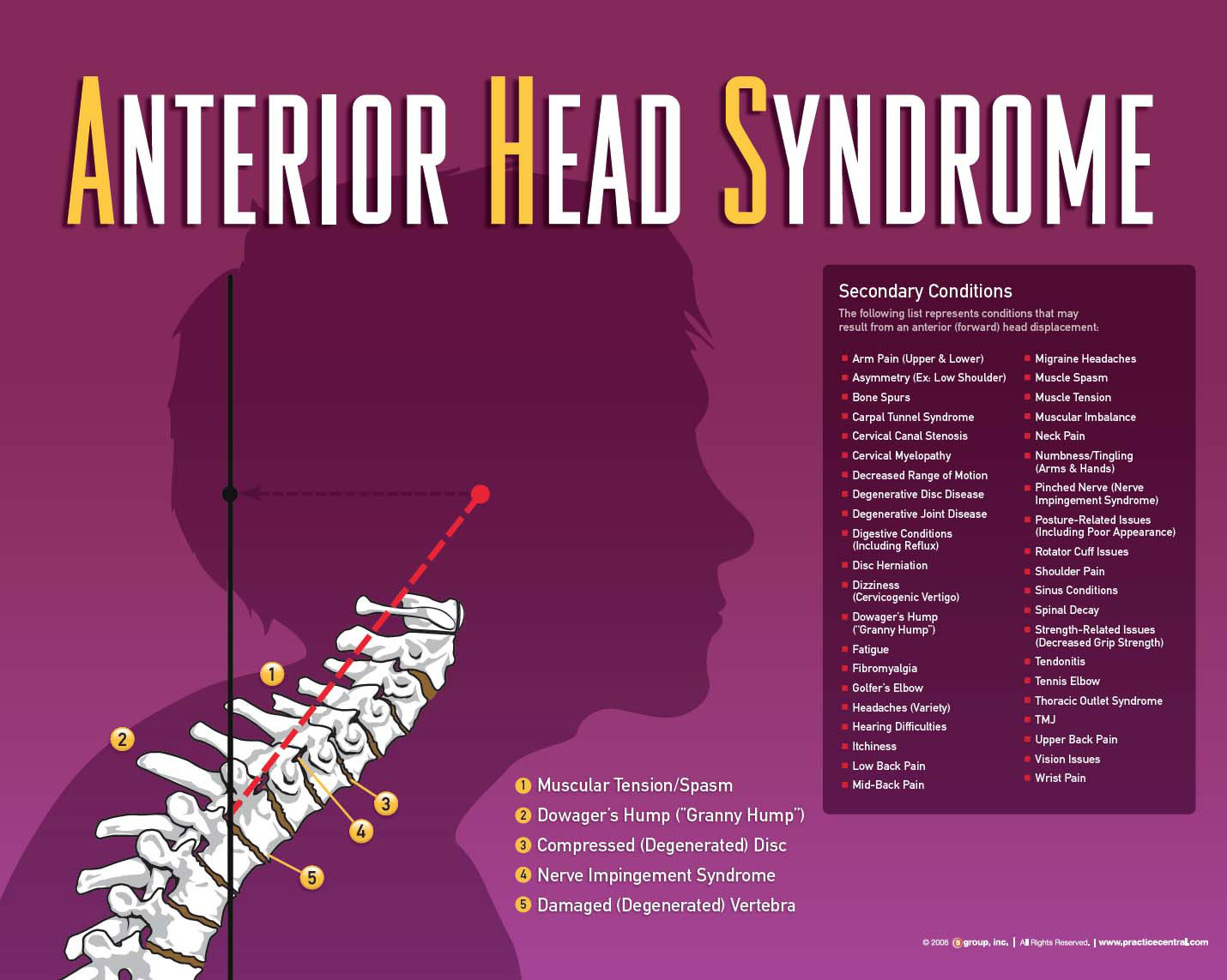 Anterior head syndrome can lead to problems like headaches, migraines, shoulder pain, TMJ, disc degeneration, muscle spasm, nerve impingement.