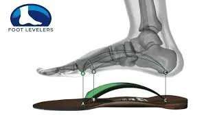 X-ray of a foot over custom orthotics insole, showing arch support and labeled points; Foot Levelers logo in corner.