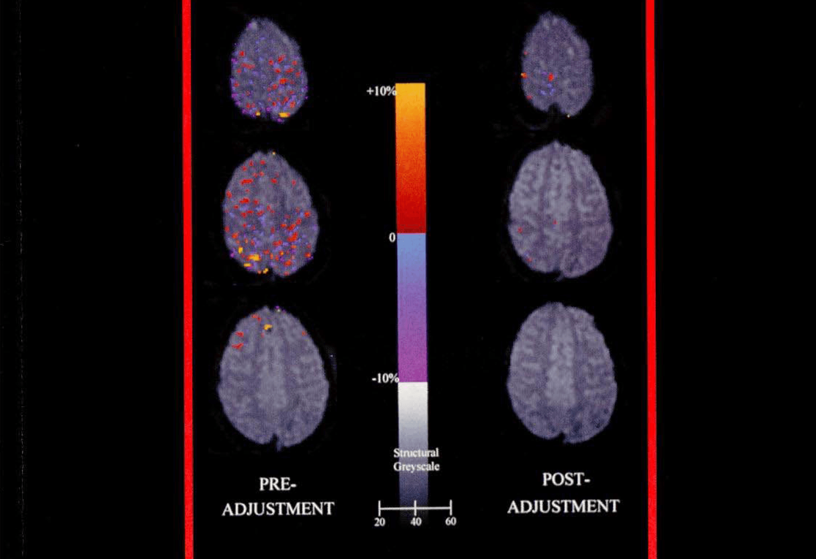 Functional Magnetic Resonance Imaging: About the Cover (cover picture)