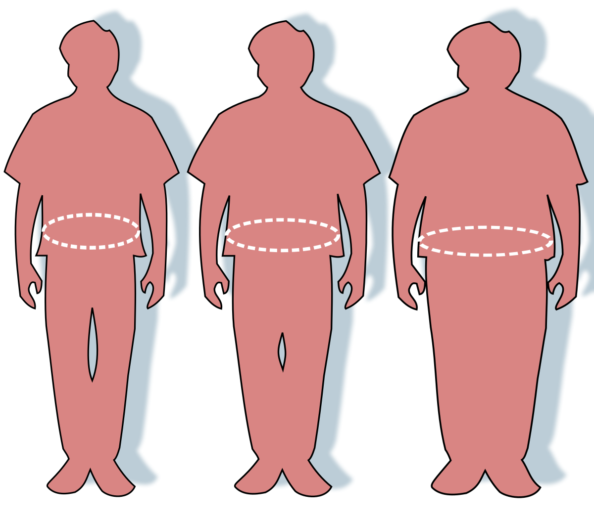 What is the Cure to Obesity?