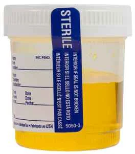 Soccer Fans Banned for Life Because They THREW THEIR PEE AT SOMEONE