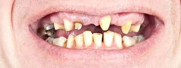 Bag of Meth Found Among Halloween Candy Brethren- Kids Start Losing Teeth Even Faster!