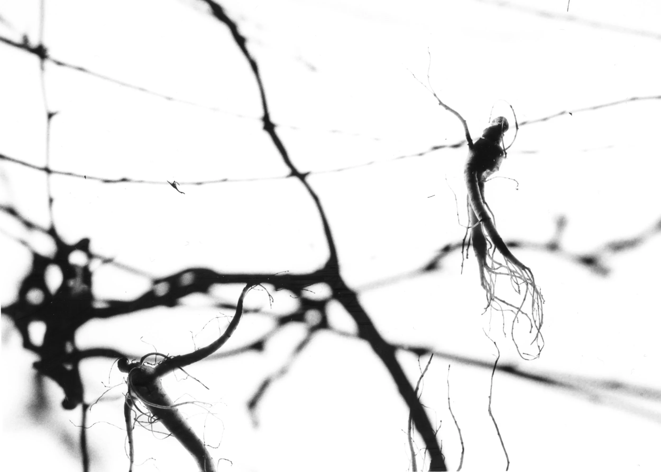 2017, Gelatin Silver Print Multiple Scars explores living with Multiple Sclerosis. 