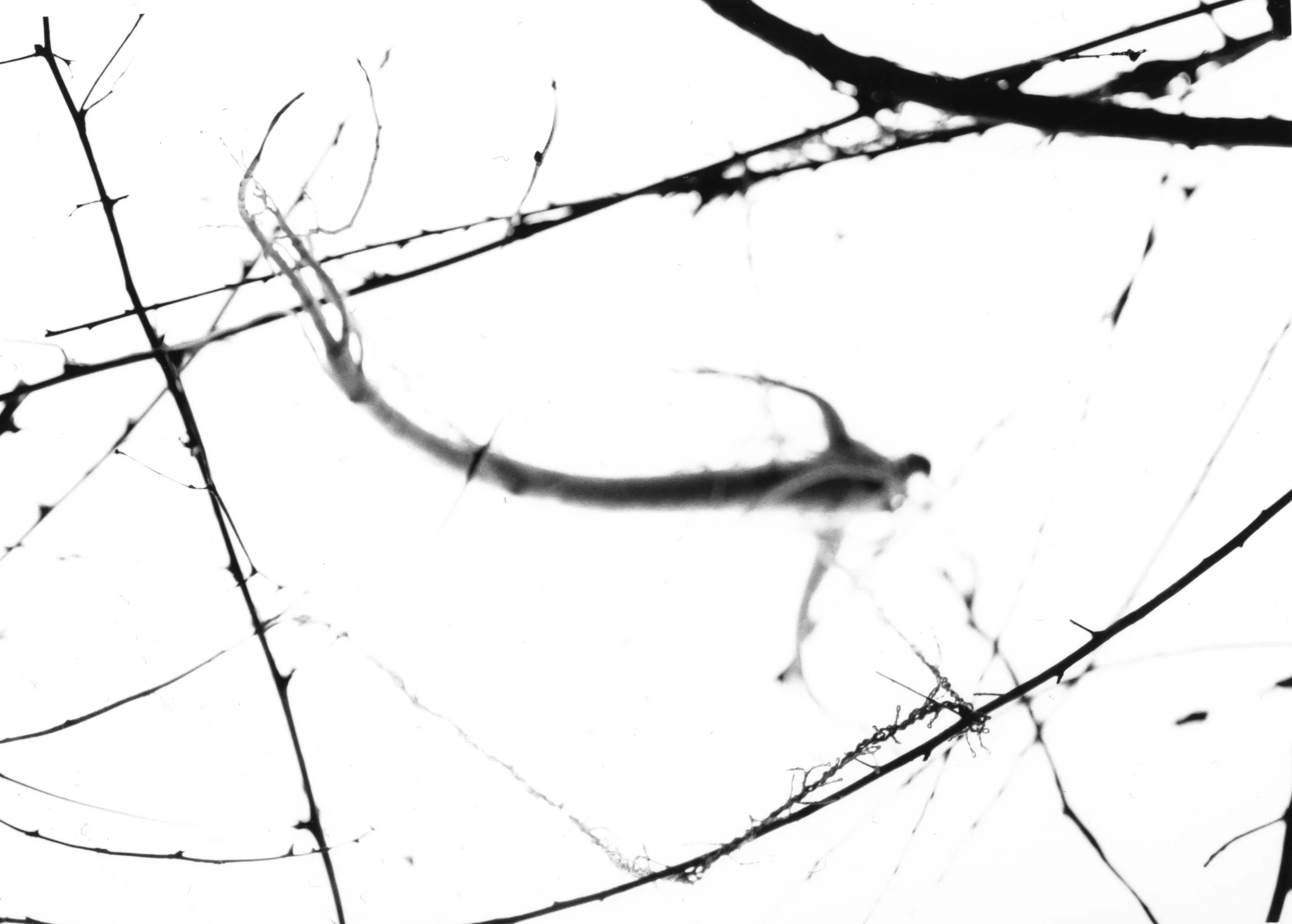 2017, Gelatin Silver Print Multiple Scars explores living with Multiple Sclerosis. 