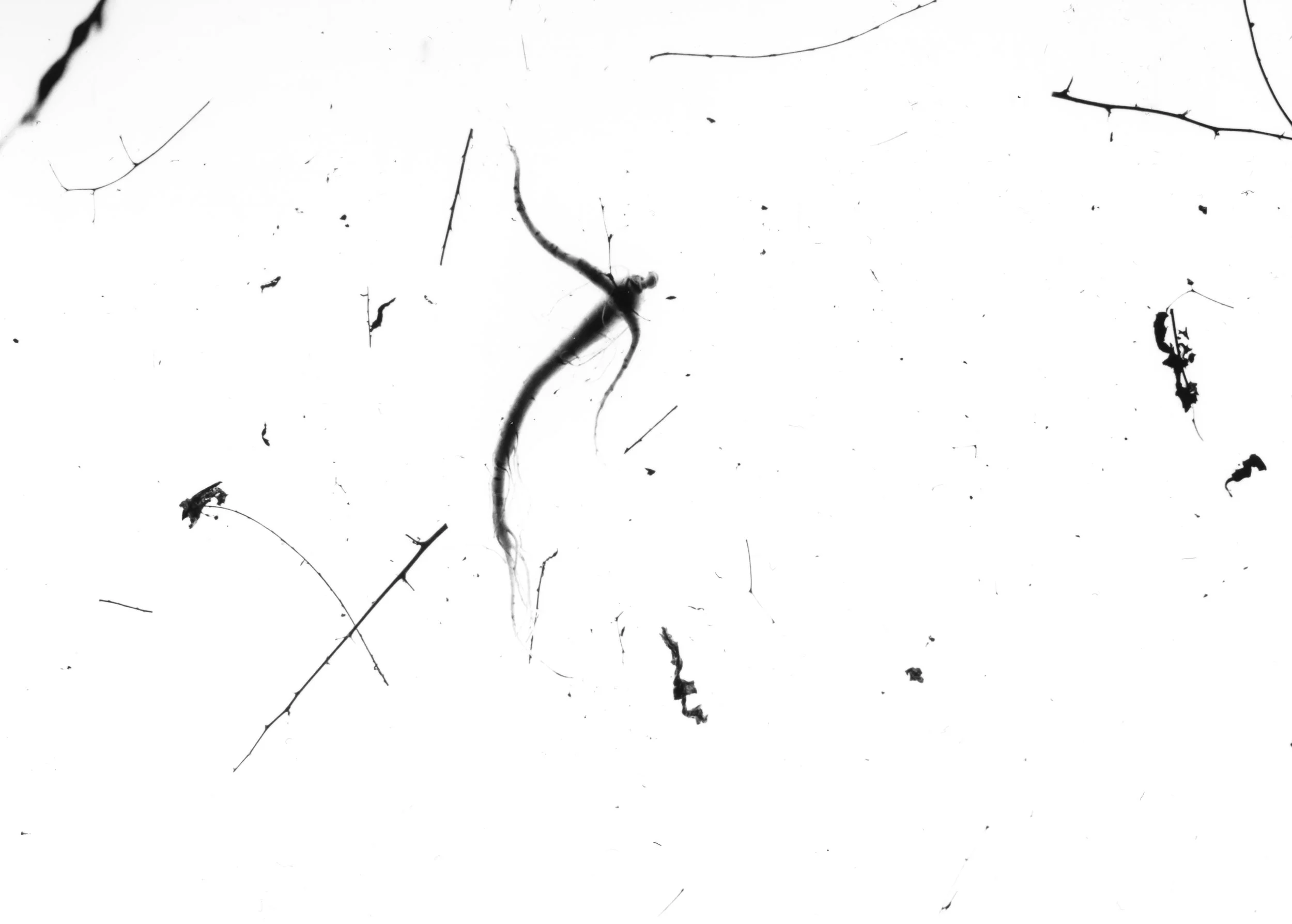 2017, Gelatin Silver Print Multiple Scars explores living with Multiple Sclerosis. 