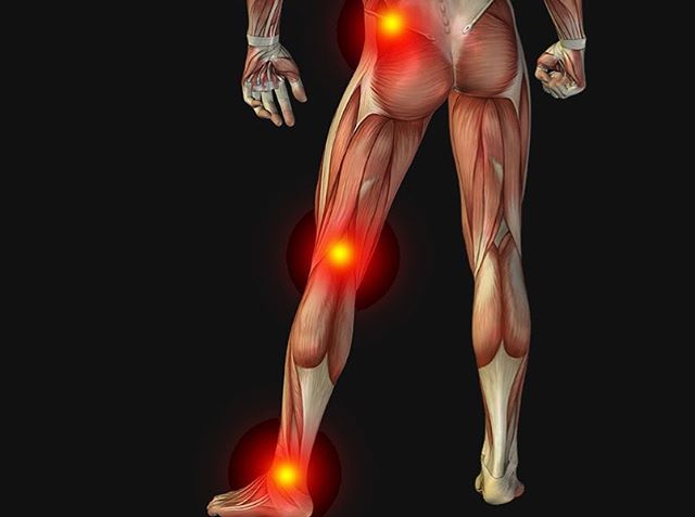 Check out our most recent blog article on sciatica and how PT can help you alleviate your pain from it! Link in BIO!
#rehab #evolve #physicaltherapy #sciatica #lowbackpain #sportsrehab