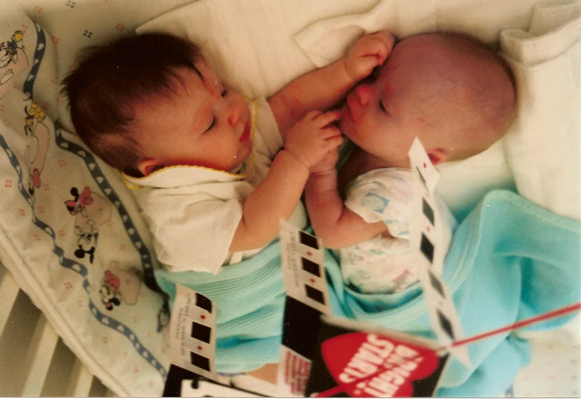Coping with a Down Syndrome Diagnosis-- A Twin's Perspective