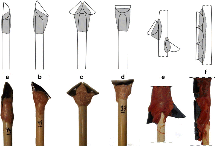 Examples of obsidian crescents hafted onto arrows at different orientations. Projectile experiments showed while (a) and (b) penetrated deeper on average, obliquely oriented pieces (d) was the most resistant to damage, even sometimes breaking bone without showing evidence of damage (see below).