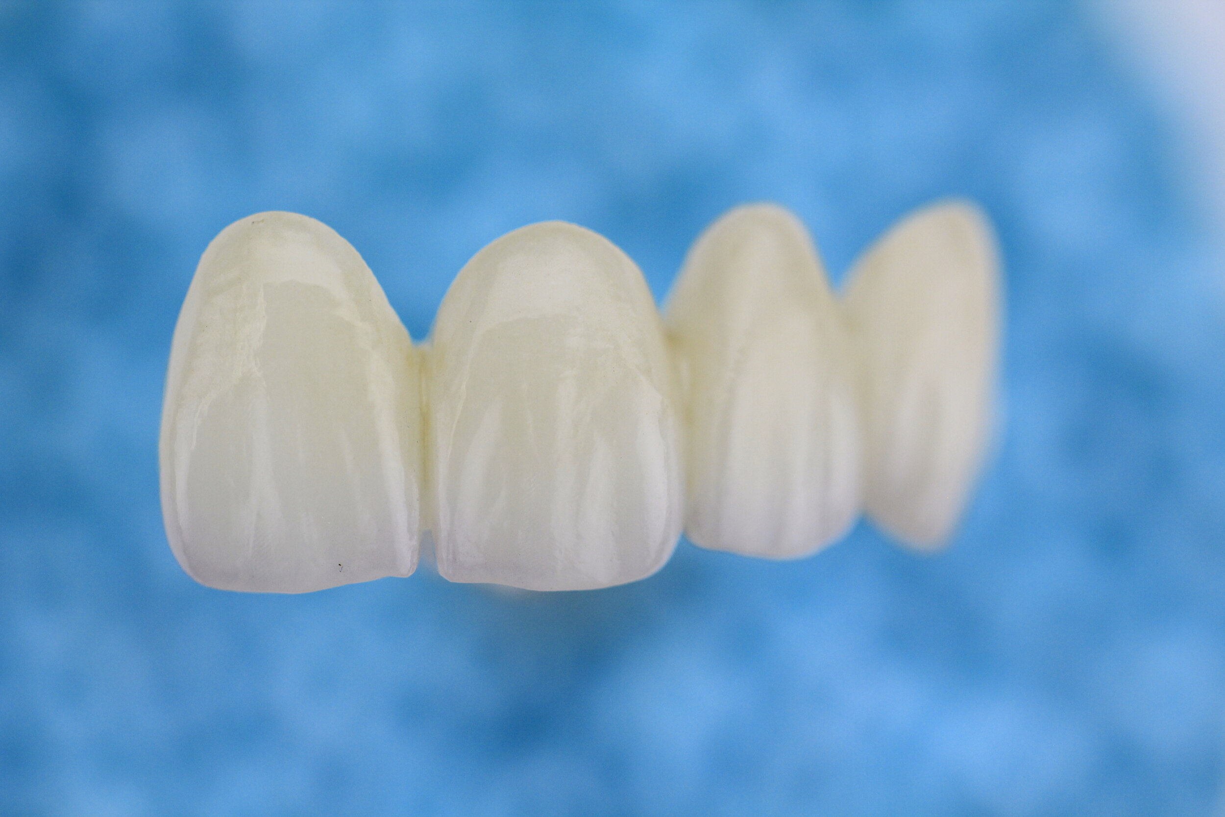 Layered Zirconia