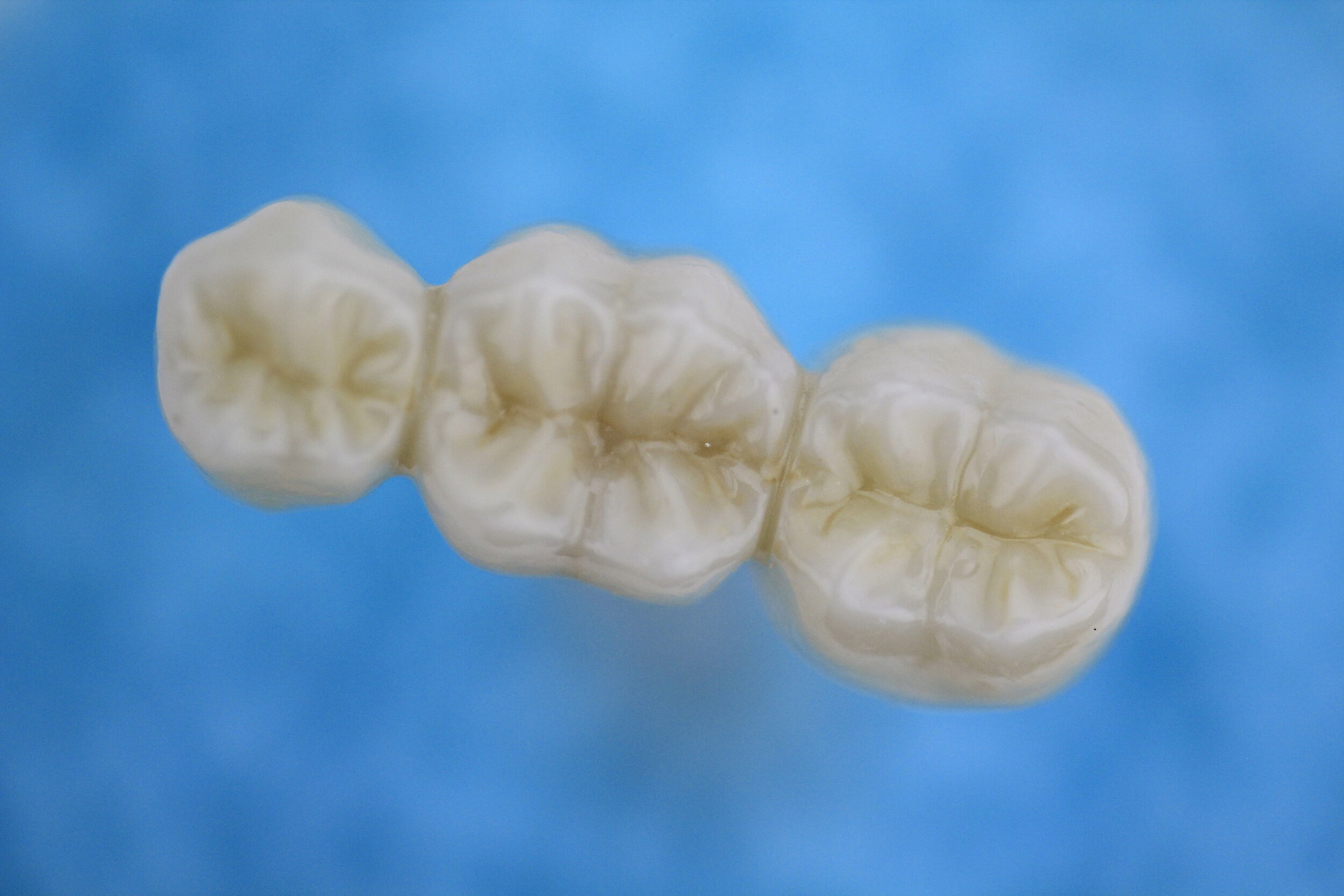 Full Strength Zirconia