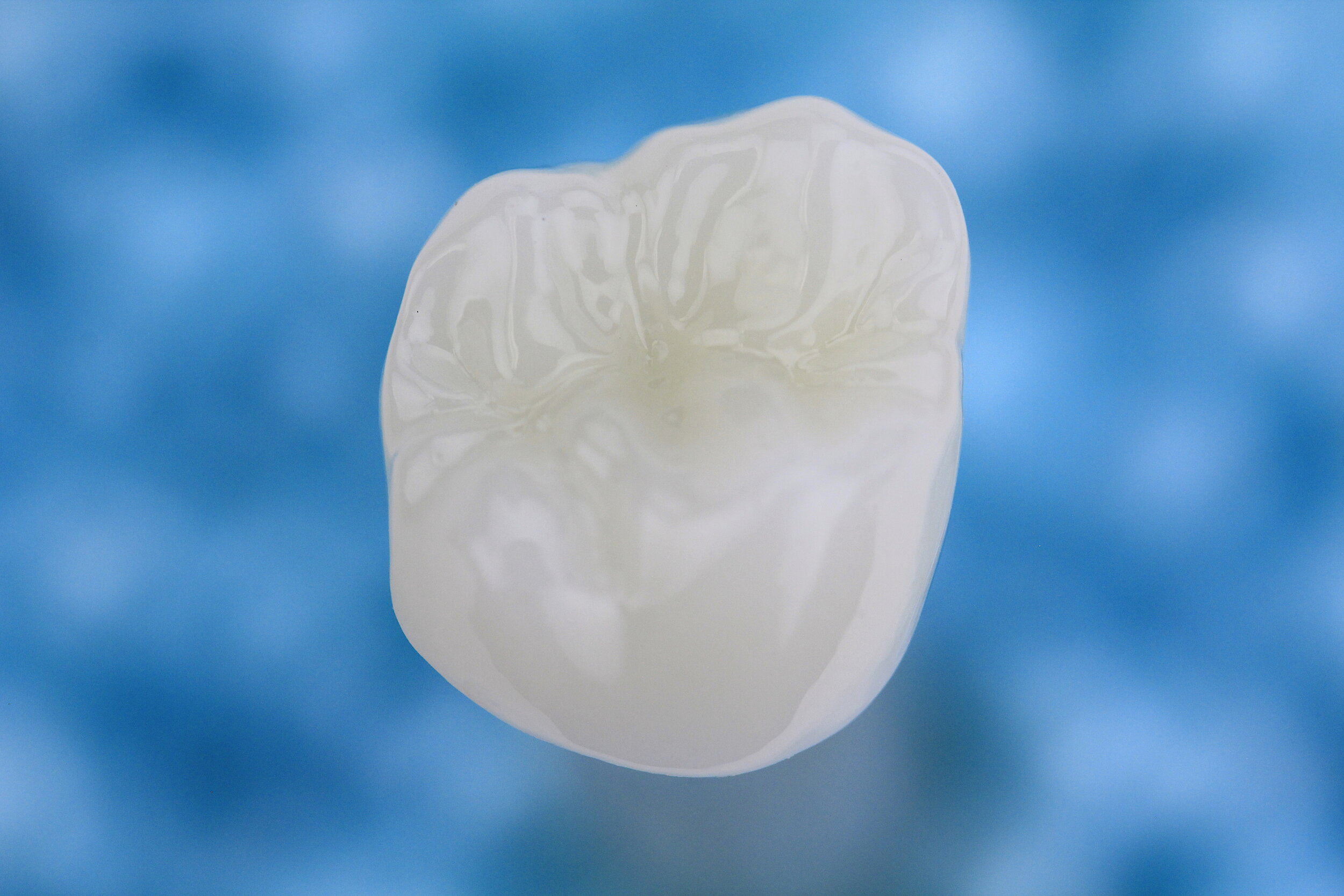 Zirconia — 38 Smiles Dental Laboratory