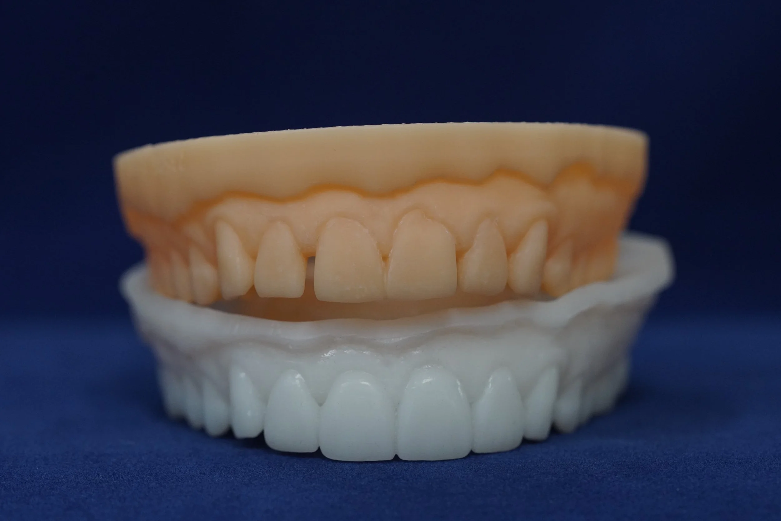 Diagnostic WaxUps — 38 Smiles Dental Laboratory