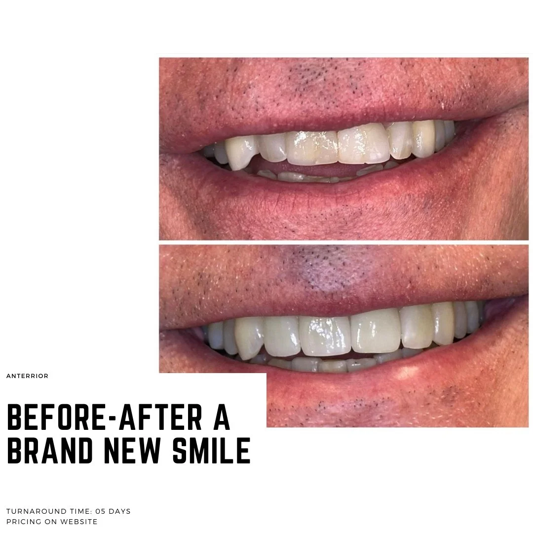 Lab Form Smile Images — 38 Smiles Dental Laboratory