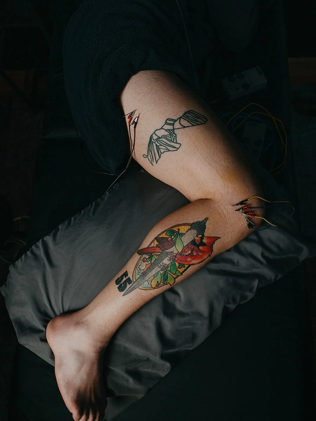 Acupuncture, electrical stimulation and red light therapy for lateral knee pain
Even if you know something is structurally wrong with your tissues, acupuncture can be a great way to help strengthen your movement patterns as an essential part of the